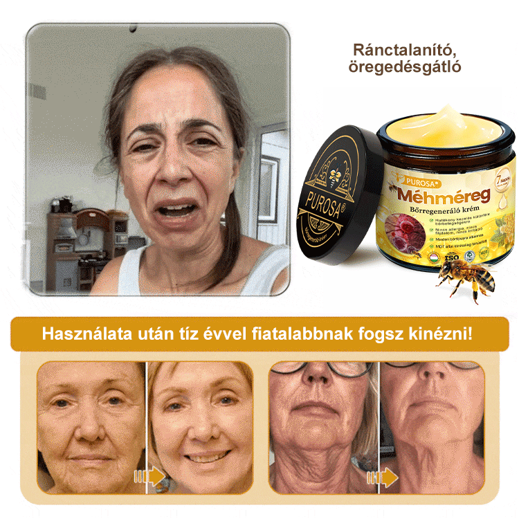🍋PUROSA® Méhméreg Bőrmegújító Krém|✅Teljes körű megoldás a makacs bőrproblémák, például az öregedés, ekcéma, hegek és pikkelysömör ellen