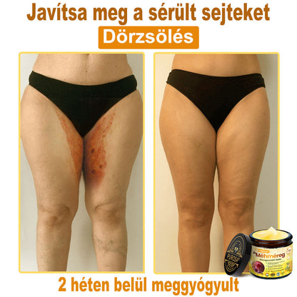 🍋PUROSA® Méhméreg Bőrmegújító Krém｜✅Teljes körű megoldás a makacs bőrproblémák, például az öregedés, ekcéma, hegek és pikkelysömör ellen