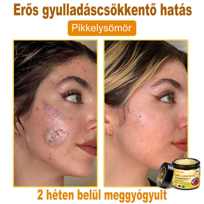 🐝PUROSA®  🎁🎁 Utolsó esély! Kapd meg ezt a szerencsés leletet 🎉70%-os KEDVEZMÉNYEL!