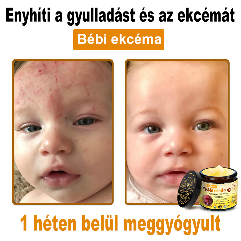 🐝PUROSA®  🎁🎁 Utolsó esély! Kapd meg ezt a szerencsés leletet 🎉70%-os KEDVEZMÉNYEL!