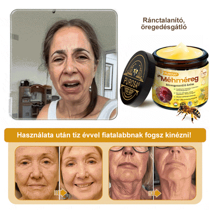 🍋PUROSA® Méhméreg Bőrmegújító Krém｜✅Teljes körű megoldás a makacs bőrproblémák, például az öregedés, ekcéma, hegek és pikkelysömör ellen