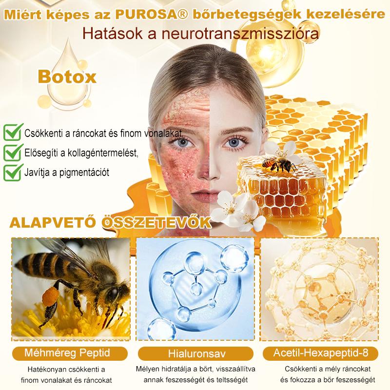 🐝PUROSA®  🎁🎁 Utolsó esély! Kapd meg ezt a szerencsés leletet 🎉70%-os KEDVEZMÉNYEL!