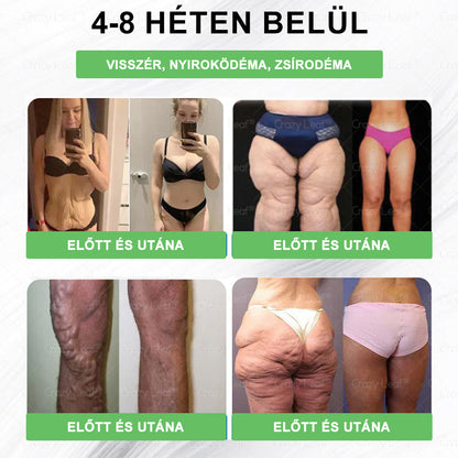 🍏𝐓𝐞𝐥𝐣𝐞𝐬 𝐭𝐞𝐬𝐭 𝐞𝐠é𝐬𝐳𝐡𝐞𝐠é𝐠𝐞 𝐢𝐭𝐭 𝐤𝐞𝐳𝐝ő𝐝𝐢𝐤 ✅ 𝐂𝐫𝐚𝐳𝐲𝐋𝐞𝐚𝐟® 𝐆𝐋𝐏-𝟏 𝐌𝐎𝐑𝐈𝐍𝐆𝐀 𝐅𝐨𝐠𝐲ó𝐤ú𝐫á𝐬 🛡️ & 𝐄𝐠é𝐬𝐳𝐡𝐞𝐠𝐟𝐨𝐤𝐨𝐳ó 𝐂𝐬𝐞𝐩𝐩𝐞𝐤 💪 – Magas vérnyomás, pajzsmirigy alulműködés, magas vércukor, elhízás, bőr feszesítése