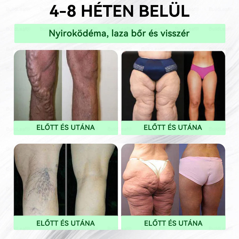 🇭🇺 Már csak 5 doboz maradt! A BuildLeaf® 🎁további 50% kedvezményt ad! Állítsd helyre a tested és az egészséged. Használd ki most, később már nem lesz rá lehetőséged.