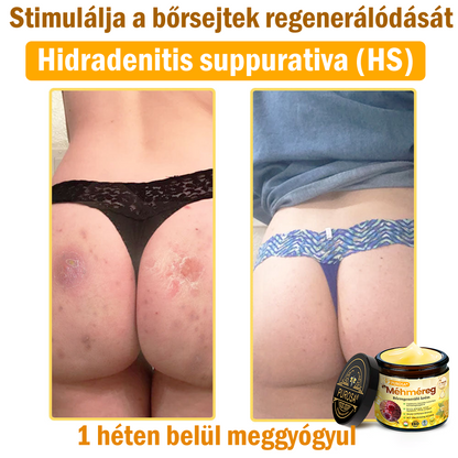 🐝PUROSA®  🎁🎁 Utolsó esély! Kapd meg ezt a szerencsés leletet 🎉70%-os KEDVEZMÉNYEL!