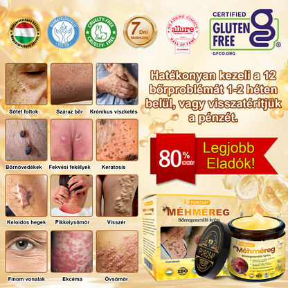🐝PUROSA®  🎁🎁 Utolsó esély! Kapd meg ezt a szerencsés leletet 🎉70%-os KEDVEZMÉNYEL!