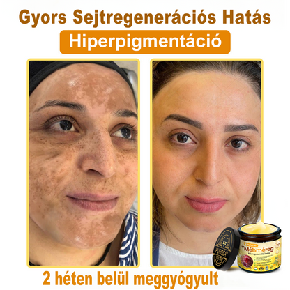 🐝PUROSA®  🎁🎁 Utolsó esély! Kapd meg ezt a szerencsés leletet 🎉70%-os KEDVEZMÉNYEL!