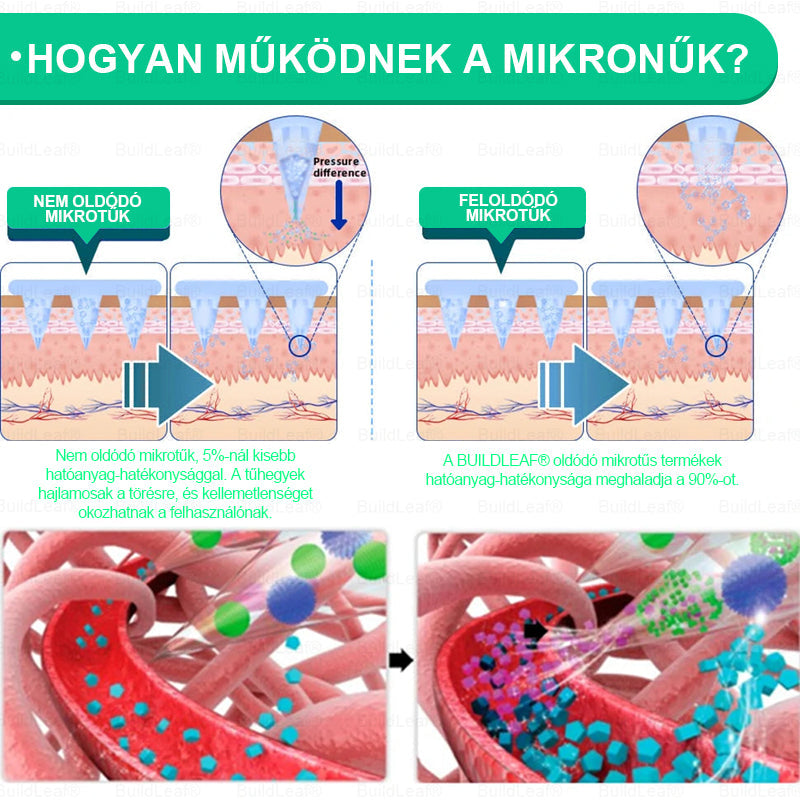 🇭🇺 Már csak 5 doboz maradt! A BuildLeaf® 🎁további 50% kedvezményt ad! Állítsd helyre a tested és az egészséged. Használd ki most, később már nem lesz rá lehetőséged.