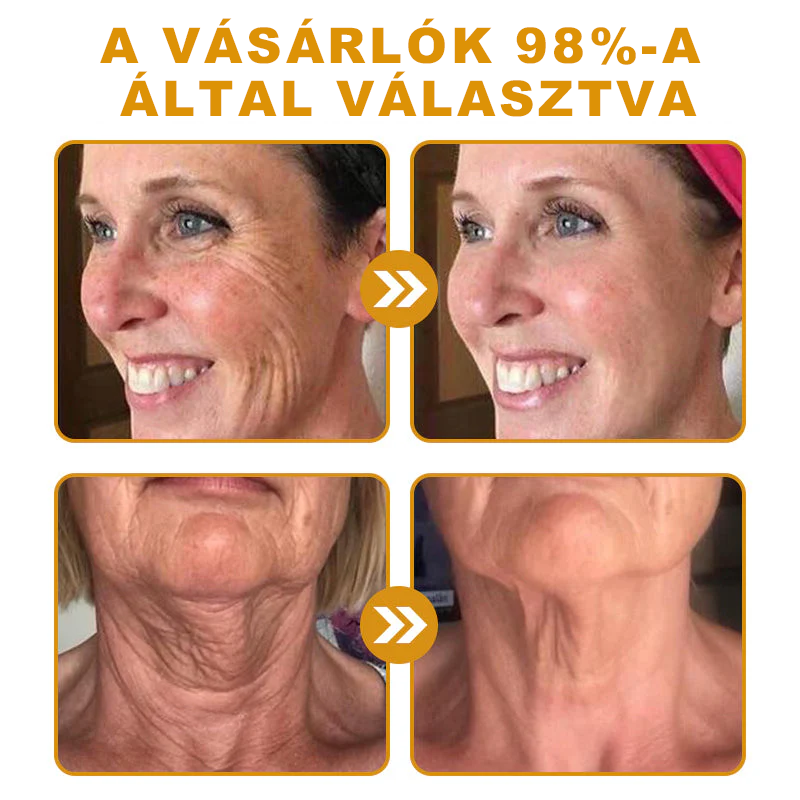 🍋PUROSA® Méhméreg Bőrmegújító Krém｜✅Teljes körű megoldás a makacs bőrproblémák, például az öregedés, ekcéma, hegek és pikkelysömör ellen