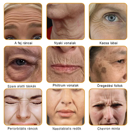 🍋PUROSA® Méhméreg Bőrmegújító Krém｜✅Teljes körű megoldás a makacs bőrproblémák, például az öregedés, ekcéma, hegek és pikkelysömör ellen