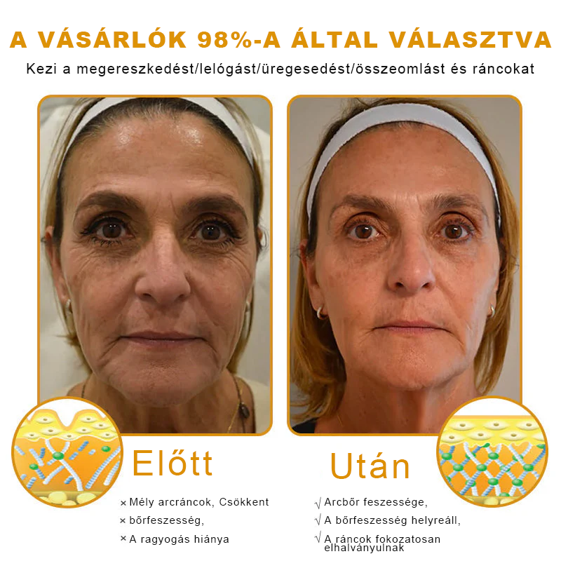 🐝PUROSA®  🎁🎁 Utolsó esély! Kapd meg ezt a szerencsés leletet 🎉70%-os KEDVEZMÉNYEL!
